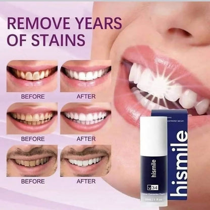 HiSmile V34 Teeth Whitening Purple Toothpaste – Color Corrector Serum for Yellow Stain Removal & Bright White Teeth
